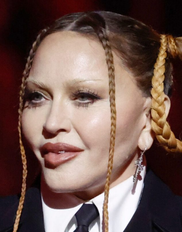 Madonna quiere volver a su antigua cara, acá la voz de un experto