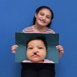 Campaña “Unidos por una Sonrisa” busca reunir 100 millones para tratamientos de fisura de labio infanto-juvenil
