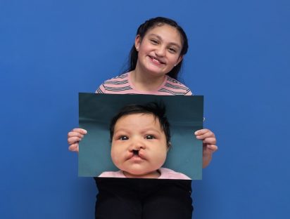 Campaña “Unidos por una Sonrisa” busca reunir 100 millones para tratamientos de fisura de labio infanto-juvenil