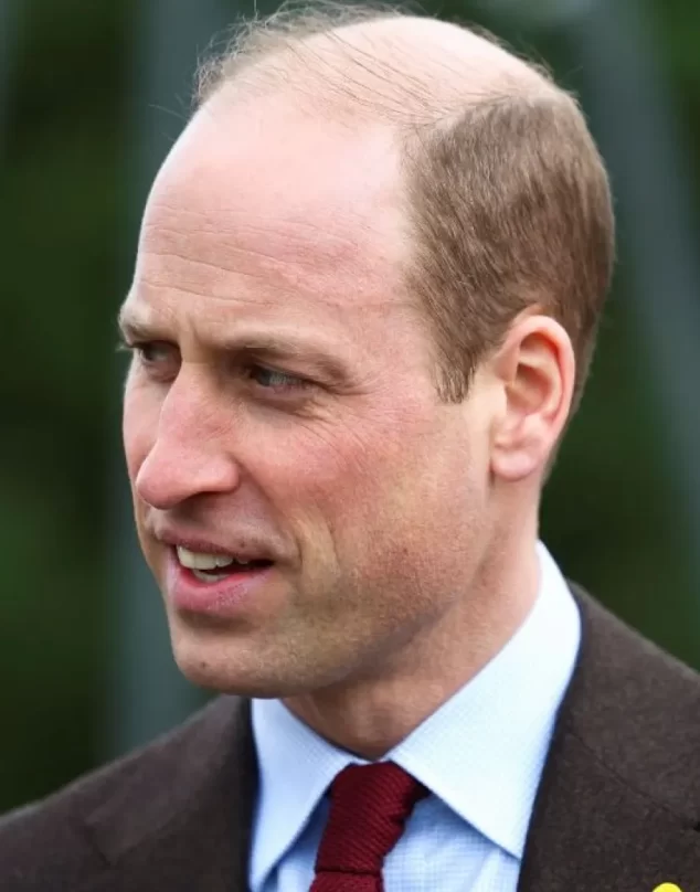 La desconocida historia de la cicatriz que luce en la frente el príncipe William