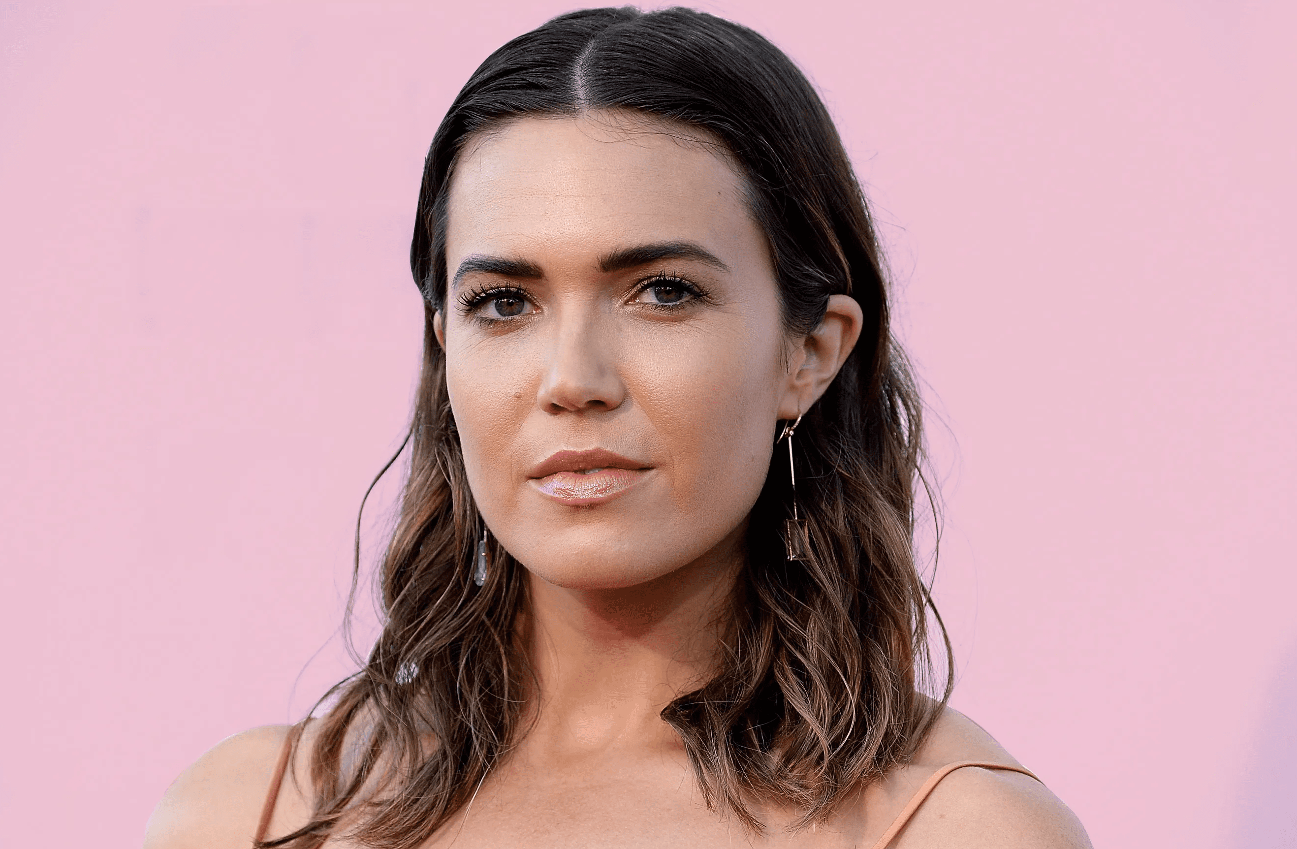 Qué es el melasma del embarazo, la condición que sufre Mandy Moore