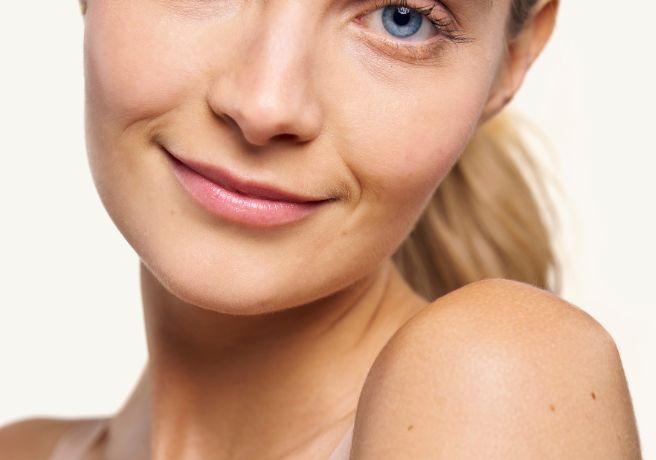 Heterofriendly: Mesoterapia no inyectable, lo nuevo en estética facial