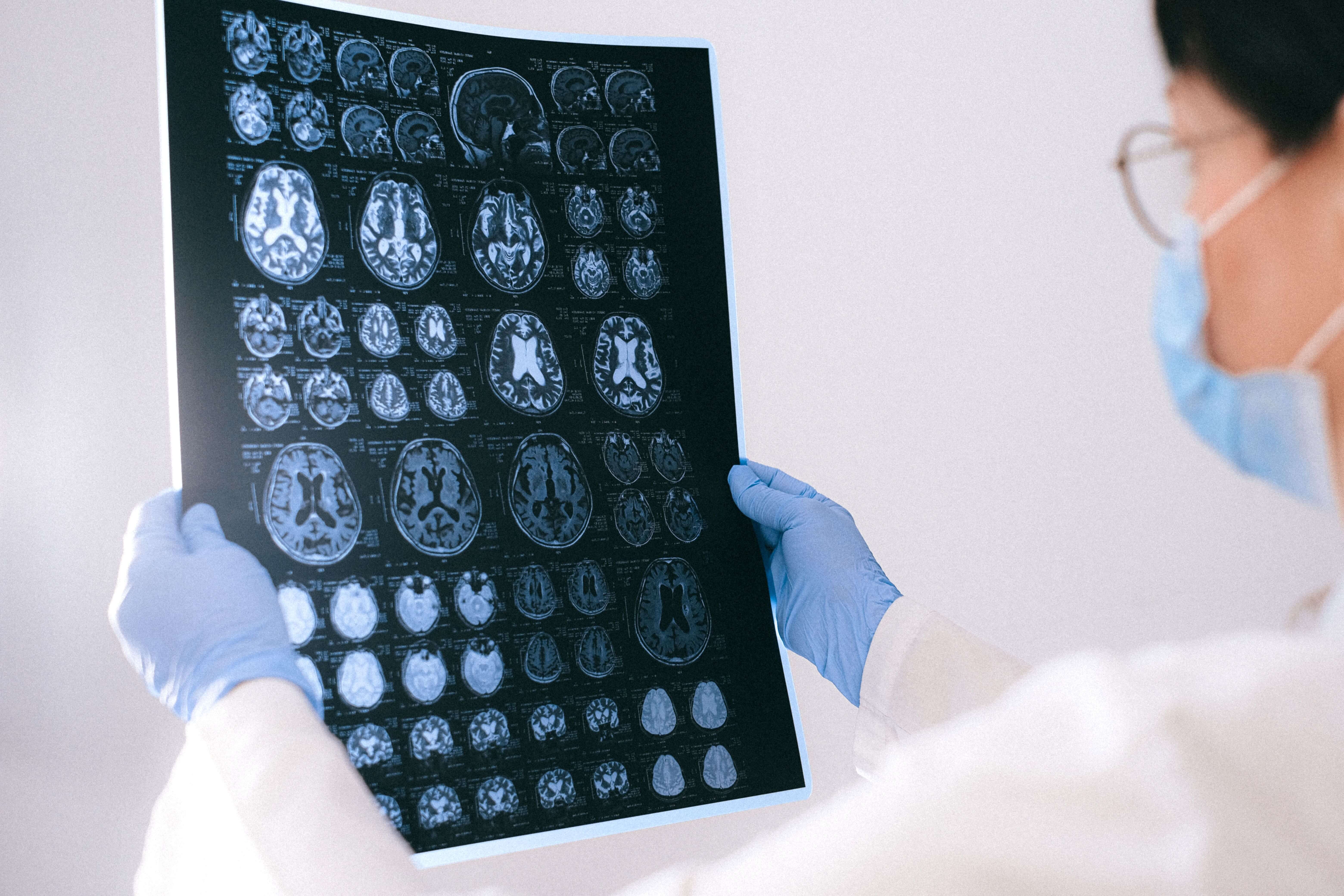 Nobel de Medicina reconoce a tres científicos por una técnica que permite controlar neuronas con luz